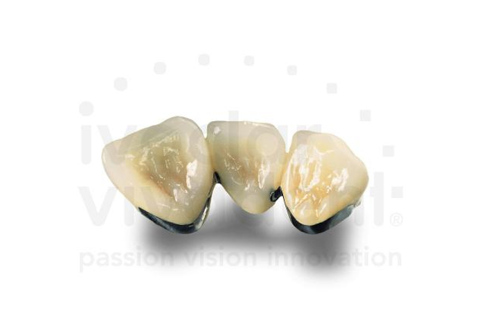 d.SIGN 30 Cobalt-chromium Porcelain Alloy