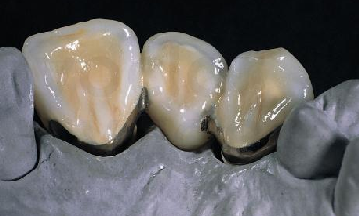 Palladium-silver Alloys